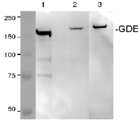 GDE / AGL | Glycogen debranching enzyme in the group Antibodies Human Cell Biology / Other proteins at Agrisera AB (Antibodies for research) (AS09 454)